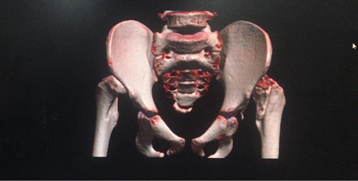 让关节重新焕发“新”活力